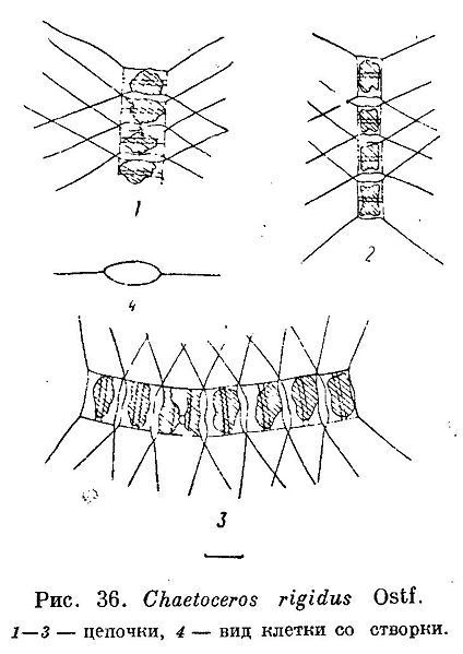 File:Chaetoceros rigidus.jpg