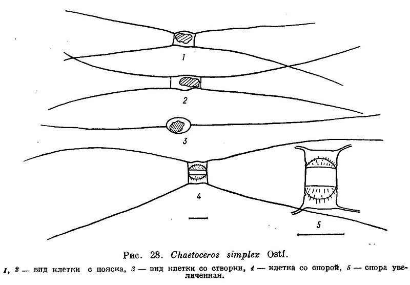 File:Chaetoceros simplex.jpg