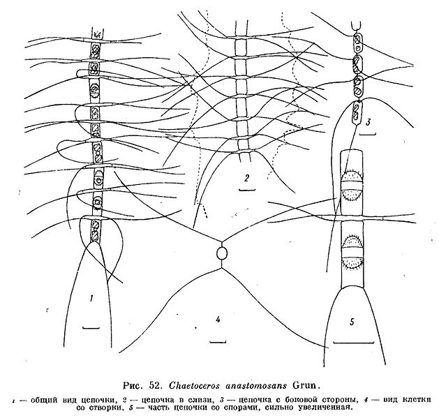 File:Chaetoceros anastomosans.jpg