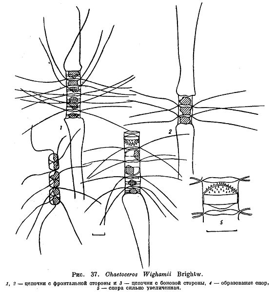 File:Chaetoceros wighamii.jpg