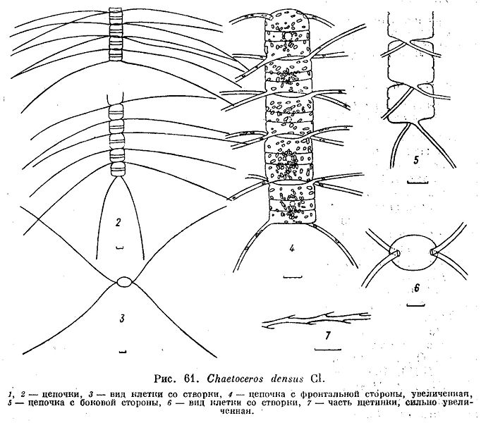 File:Chaetoceros densus.jpg